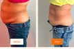 Cryotherapy Sprays & Massage: 1, 3, or 5 Session Wellness Boost at Ai stretch (Up to 30% Off) - Second Medium