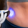Image 1: Up to 60% Off on Cryolipolysis / Fat Freezing at Miso Life