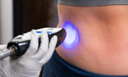 Cryolipolysis Fat Freezing Consultation and Single Session - Miso Life