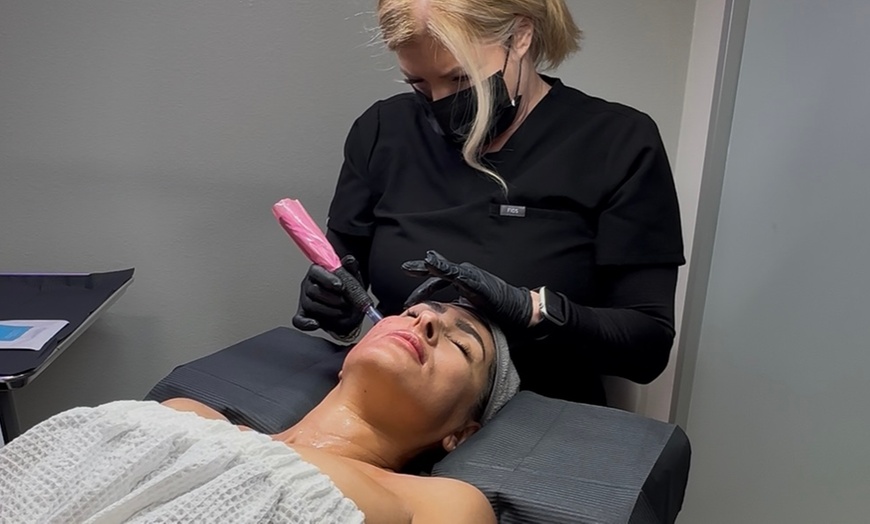 Image 1: Up to 42% Off on Micro-Needling at TGS LAB