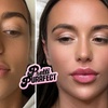 Image 5: Up to 68% Off on Injection - Dermal Filler at Pretti Purrfect