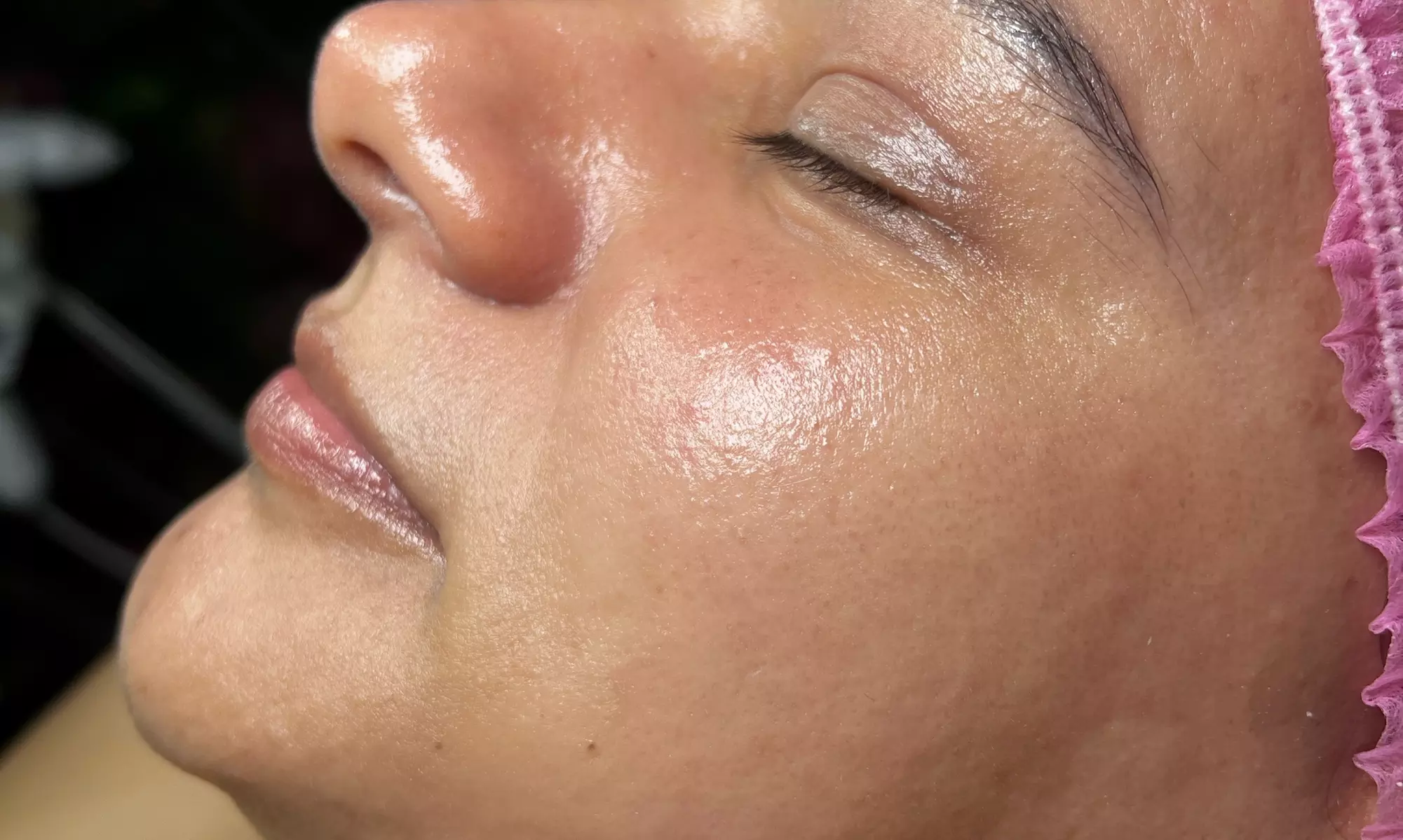 Up to 35% Off on Facial at Duda bastos aesthetics - Second Medium