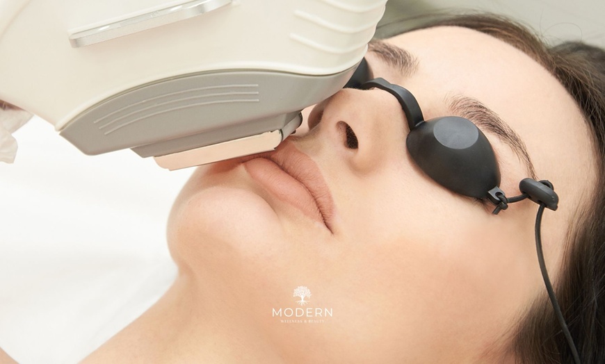 Image 2: Up to 60% Off on IPL Photo Facial at Modern Wellness & Beauty