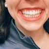 Image 4: Teeth Whitening Full Service Treatment 60-minute and More