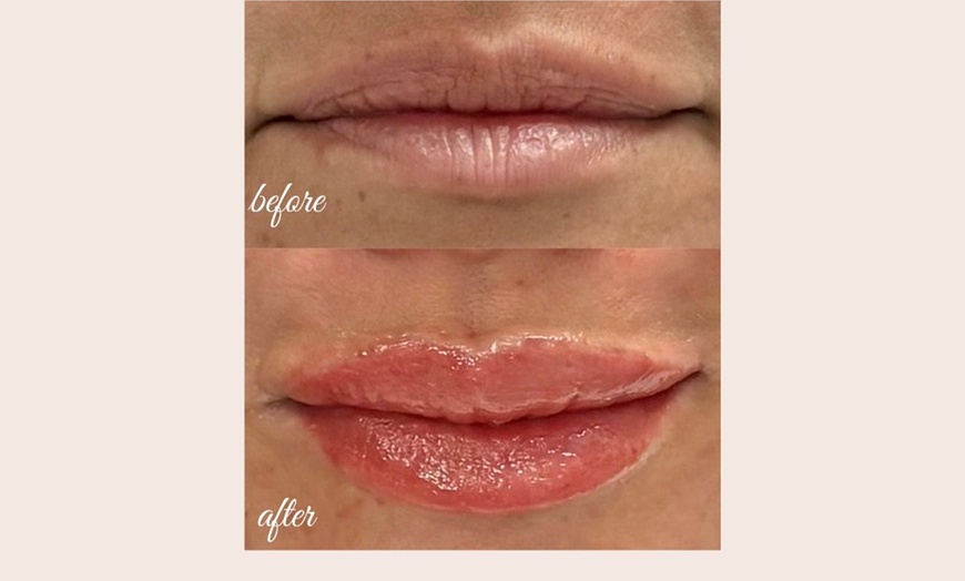 Image 3: Defined Brows & Lips with Microblading or Lip Blush