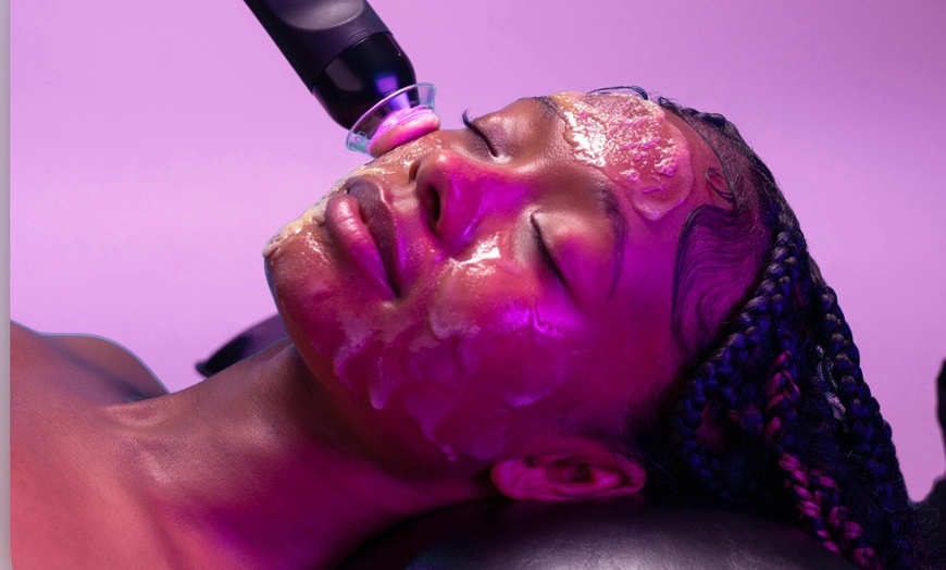 Image 2: Glo2 Facial with Radio Frequency Skin Tightening Experience