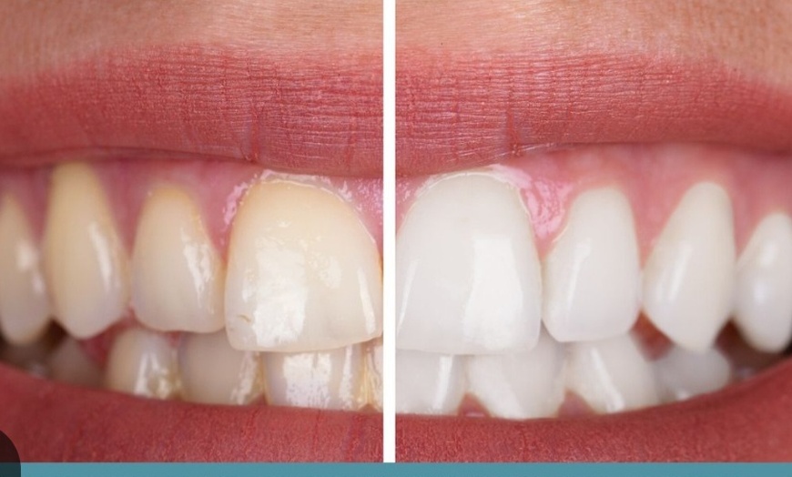 Image 1: Brighten Your Smile with Comprehensive Dental Care