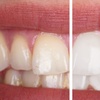 Image 1: Brighten Your Smile with Comprehensive Dental Care