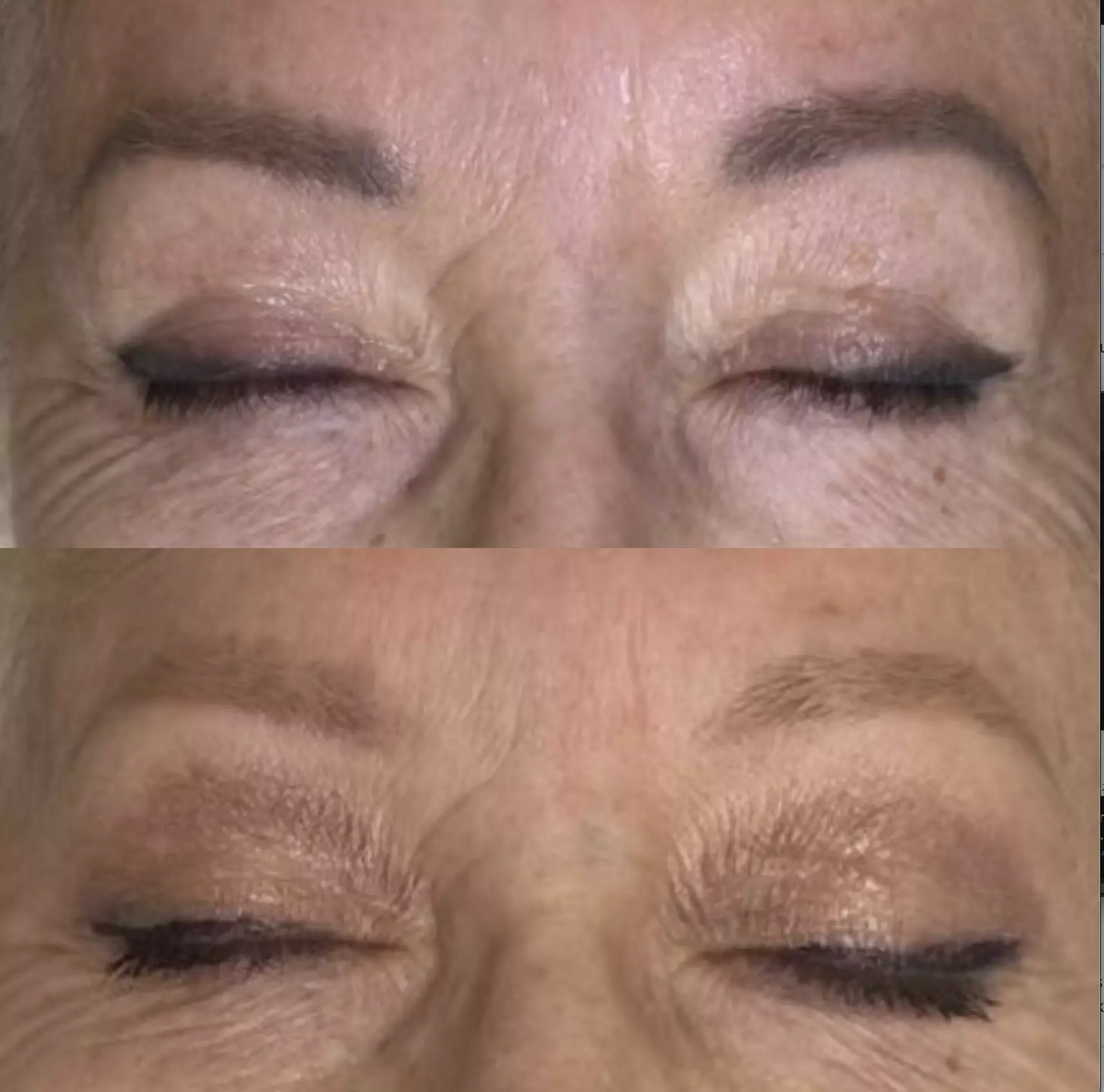 Experience Laser By Nicole - Fort Lauderdale with three tattoo removal treatments for various area sizes up to 37% off