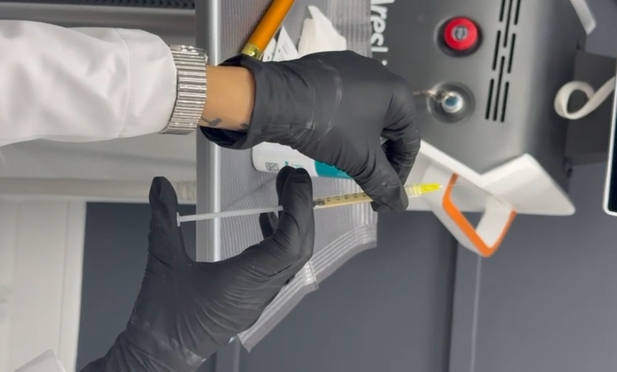 Image 5: Up to 64% Off on Hair Restoration - Non-Surgical at Estetika Med Spa