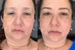 Transform Your Look with Ombré Brow Microblading at 2good2beink - Second Medium