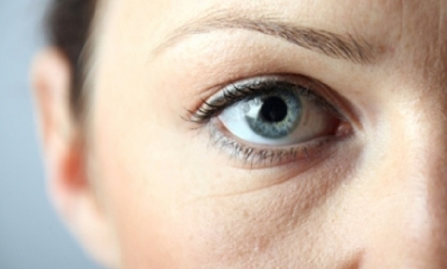 Image 2: Up to 45% Off on Injection-Other-Dysport, Xeomin at Viva Wellness of Atlanta