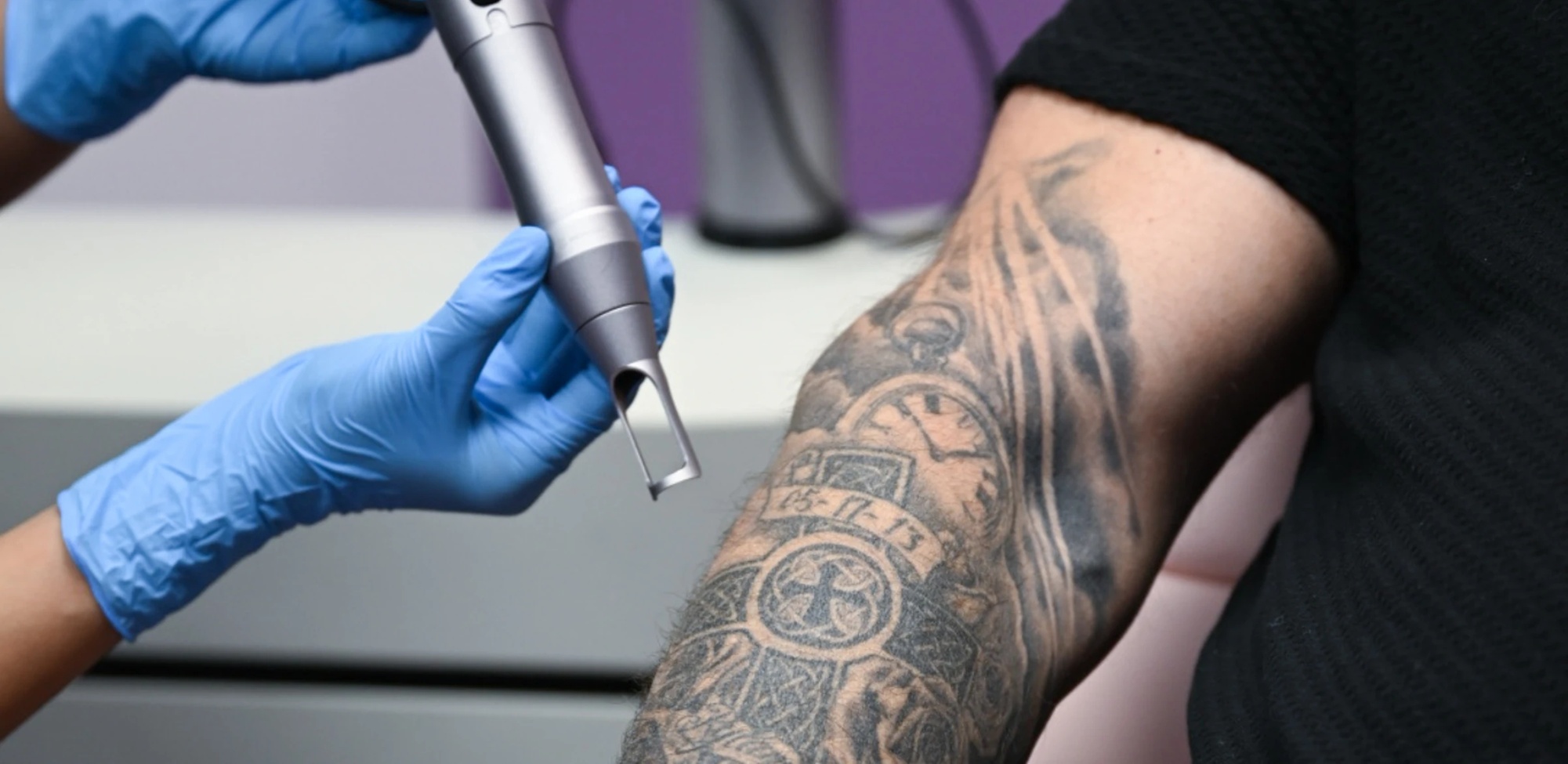 Laser Tattoo Removal Sessions for Unwanted Ink & Permanent Makeup
