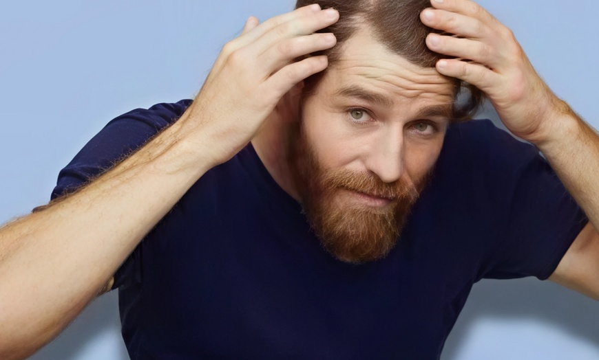 Image 3: Up to 69% Off on Salon - Scalp Care at Glow Matrix