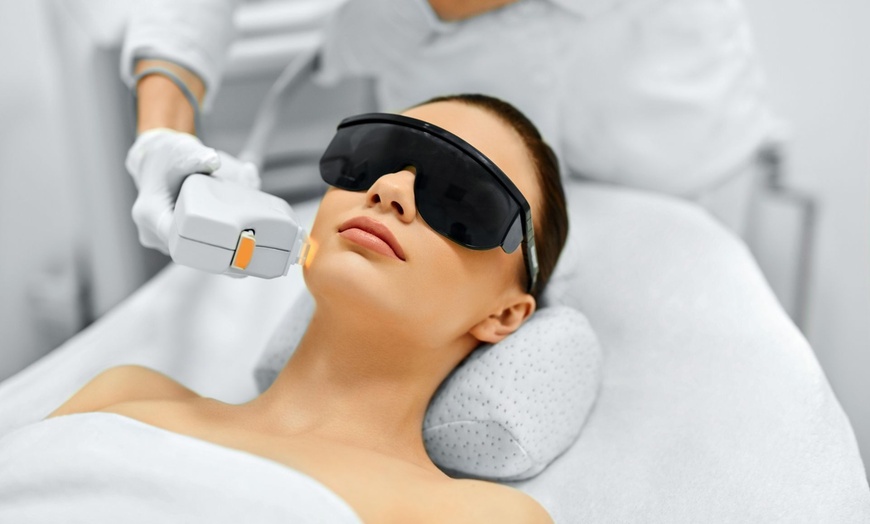 Image 1: Transform Your Skin with One or Three Full-Face Laser Resurfacing