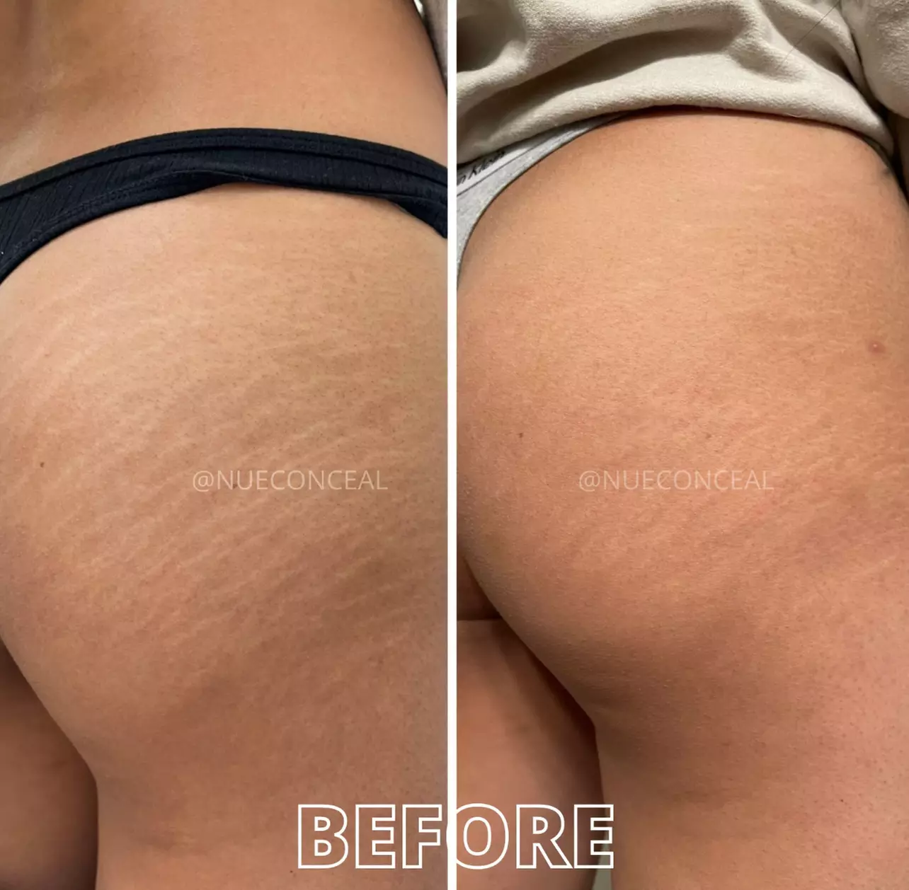 Up to 71% Off on Facial at LUXE Glow Skin Studio.