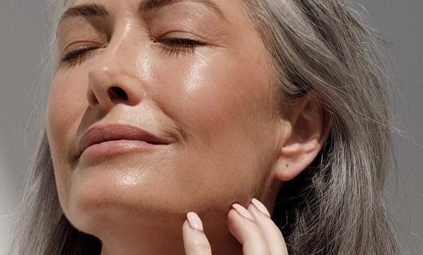 Image 3: Tratamiento de rejuvenecimiento: infiltración de hilos tensores PDO