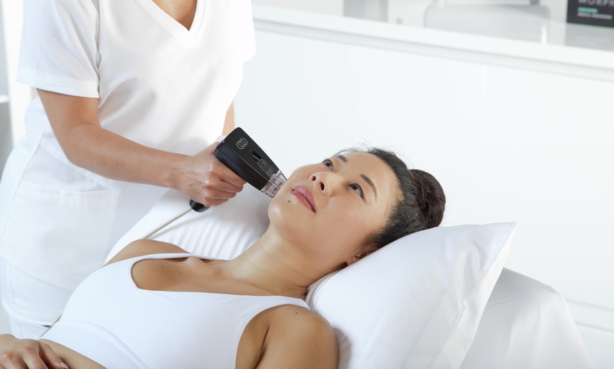Image 1: Radiant Skin Awaits: Transform with Morpheus8 RF Technology!