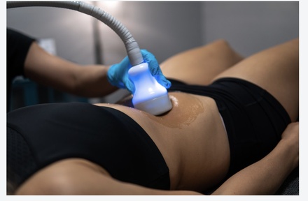 CRYO BODY TONING - Serena Spa (DermaStar Affiliate)