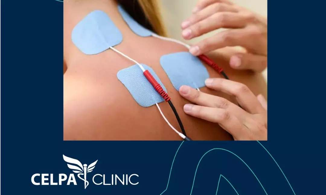 Up to 50% Off on Therapeutic Massage at Celpa Clinic - Second Medium
