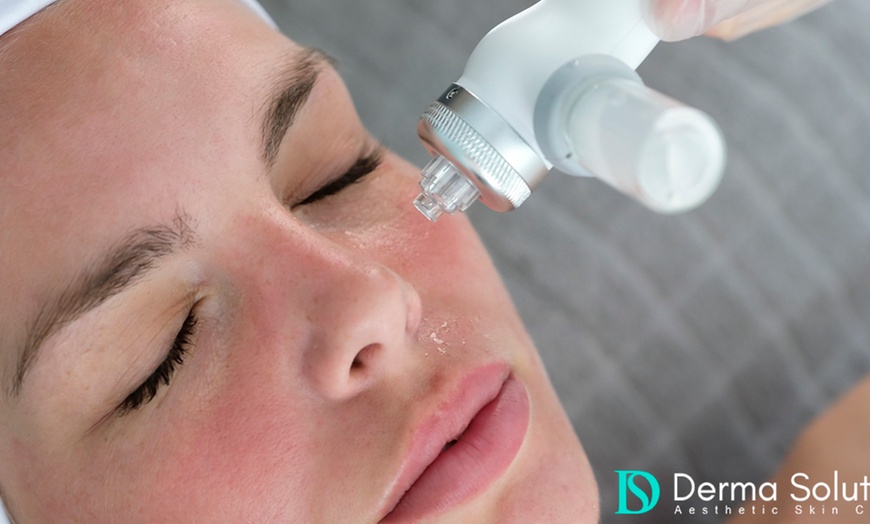 Image 13: Dive into Radiance: Unleash Your Glow with Hydrafacial - Derma Builder