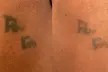 Experience Laser By Nicole - Fort Lauderdale with three tattoo removal treatments for various area sizes up to 37% off - Second Medium