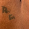 Image 4: Experience Laser By Nicole - Fort Lauderdale with three tattoo removal treatments for various area sizes up to 37% off