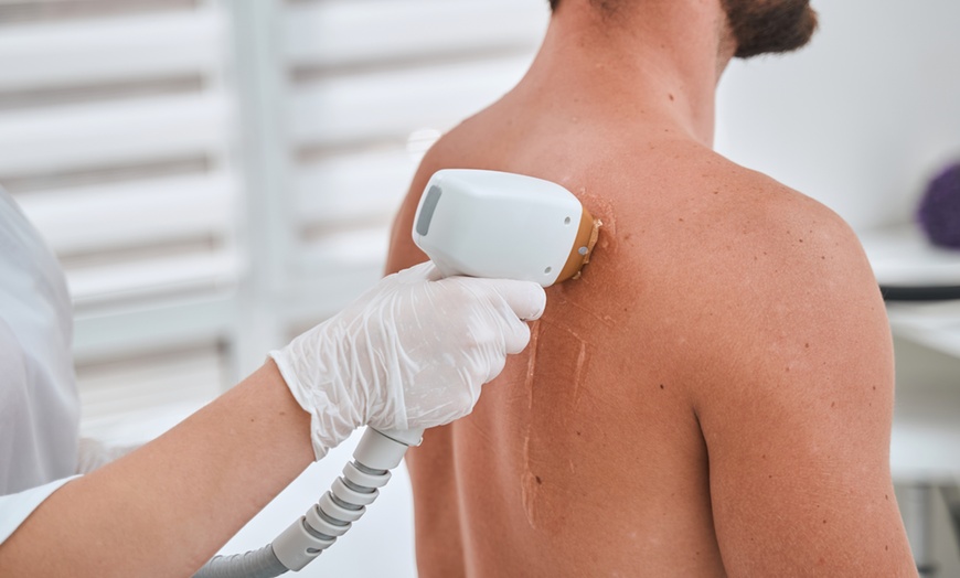 Image 6: 6 Laser Hair Removal Sessions on X-Small, Small, Medium, or Large Area