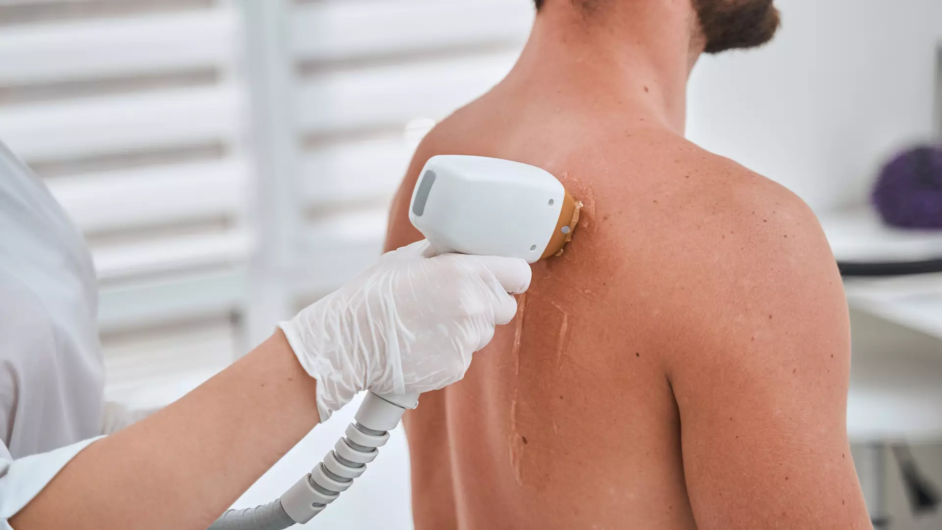 6 Laser Hair Removal Sessions on X-Small, Small, Medium, or Large Area