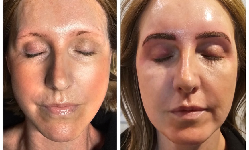 Image 10: Perfect Brows with One Microblading Session with or without Touch-Up 