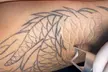 Up to 66% Off on Pico Laser Tattoo Removal at bc clinic - Image 2