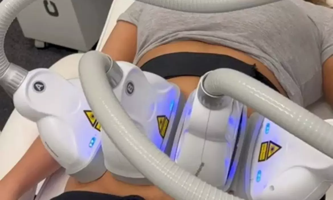 Up to 60% Off on Cavitation at UK Aesthetics Lounge