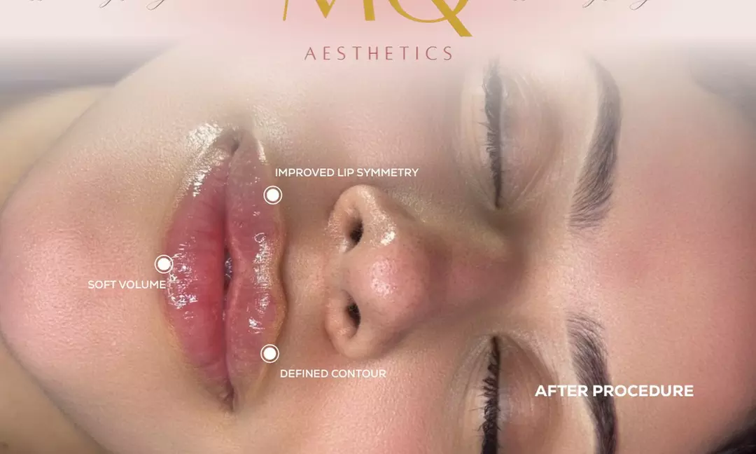 Up to 45% Off on Injection-Other-Dysport, Xeomin at MQ Aesthetics