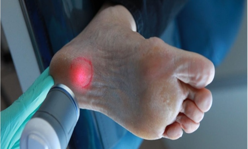 Image 2: Plantar Fasciitis treatment with One or Two Shockwave Therapy Session and Medical Foot Massage (Up to 75% Off)