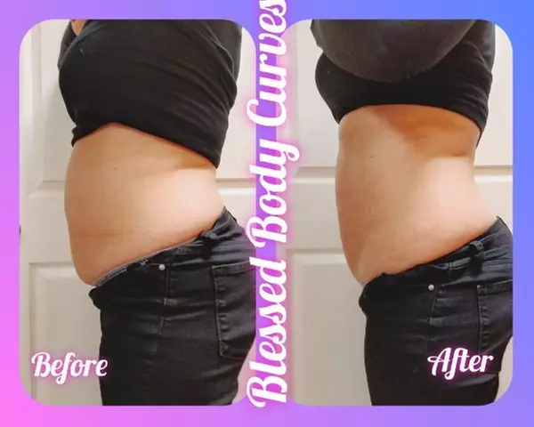 Up to 82% Off on Lipo - Non-Invasive Laser-iLipo at Blessed Body Curves