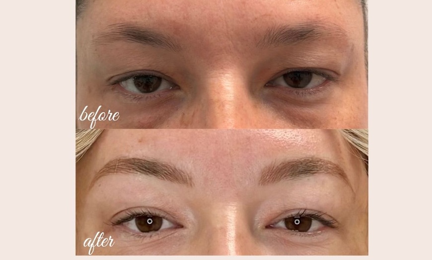 Image 4: Defined Brows & Lips with Microblading or Lip Blush