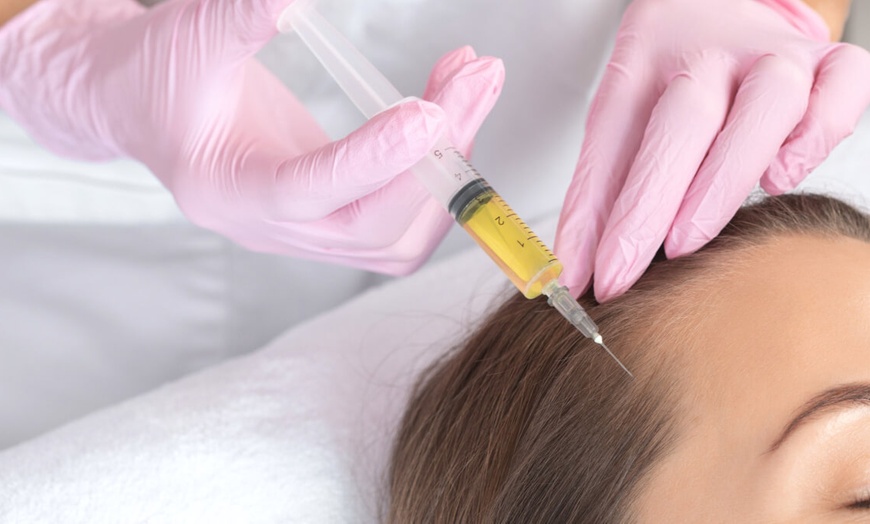 Image 2: Revitalize Your Look with One PRP Hair or Face Injectable  