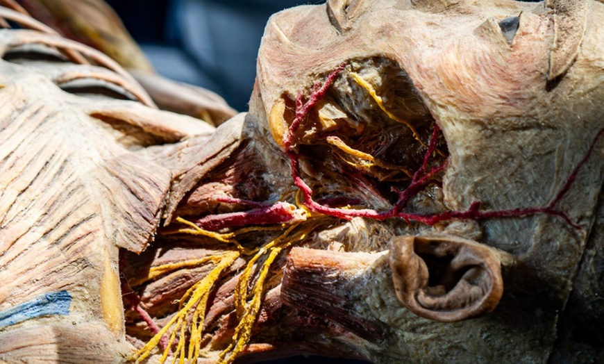 Image 2: Bodies Human: Interactive Anatomy & Health Science Exhibits