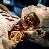 Image 2: Bodies Human: Interactive Anatomy & Health Science Exhibits