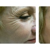 Image 2: Refresh Yourself with Xeomin Shots