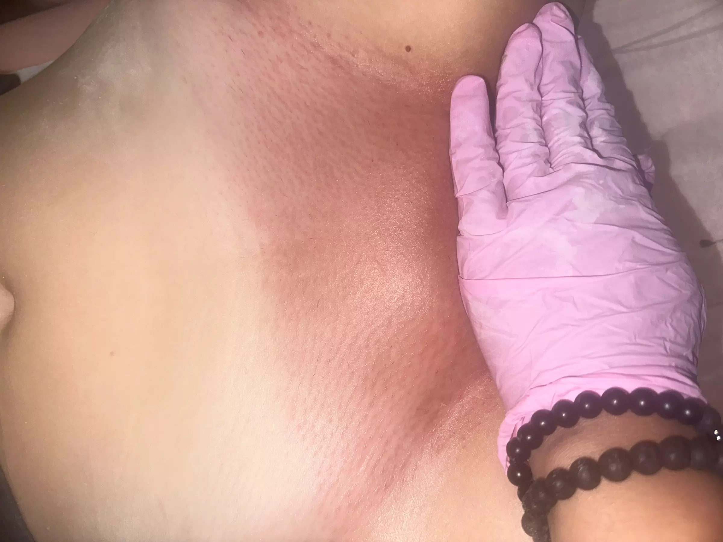 Up to 30% Off on Brazilian / Bikini Waxing at Purely aesthetics - Second Medium