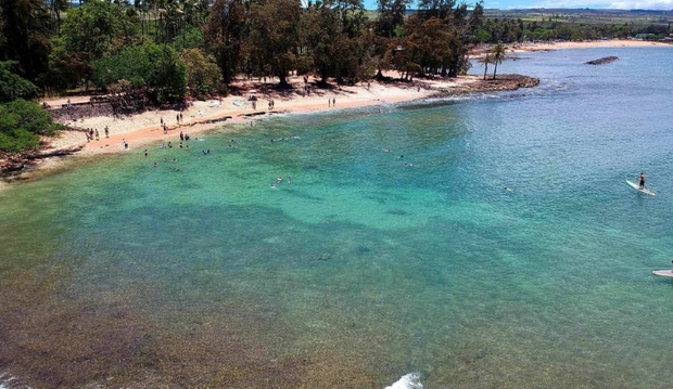 What to expect media