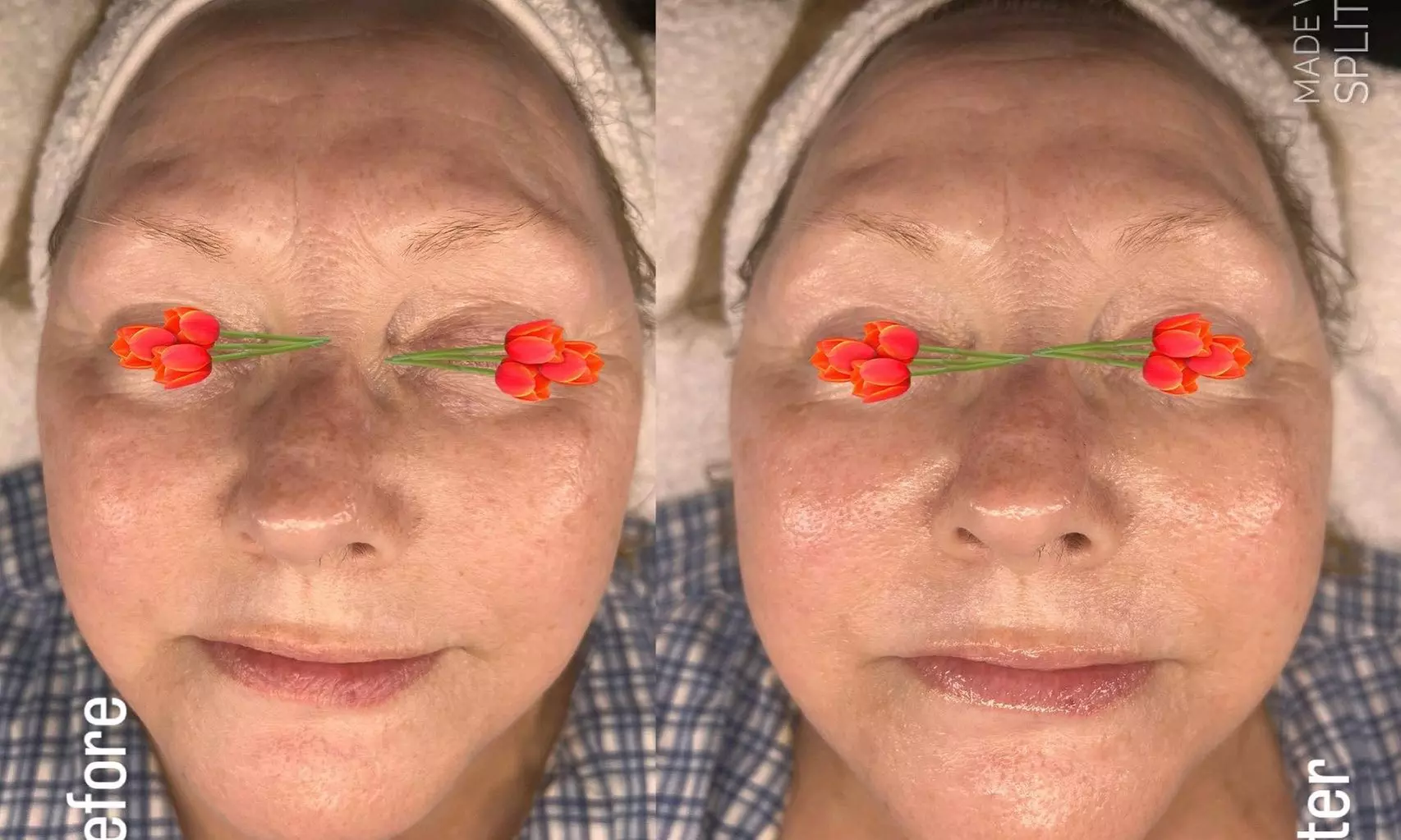 Up to 55% Off on Facial at Nu glow by k