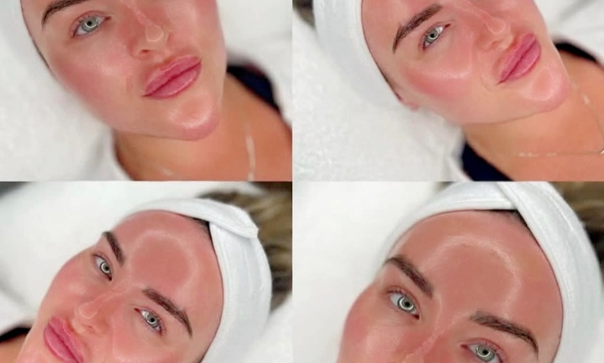 Image 3: Experience rejuvenation at Le Lux Beautique with microdermabrasion and medical-grade facials for new clients