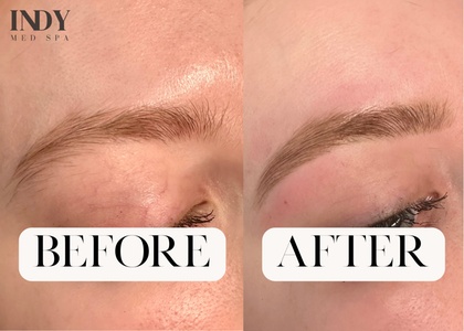 One Brow Shaping with Tint Session - The Indy Med Spa