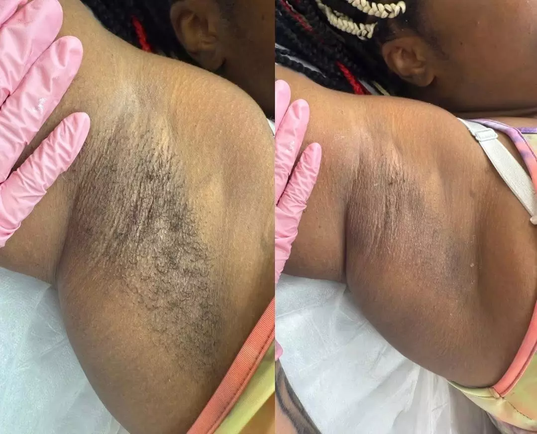 Up to 30% Off on Waxing at A.Esthetics