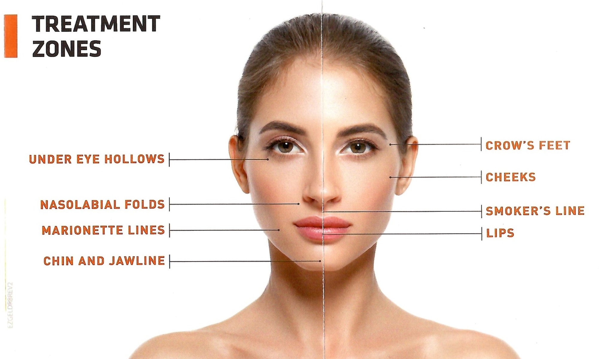 Enhance Your Look Naturally with EZ Gel Filler & PRF Therapies