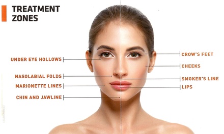 PRF (PRF - Plasma Liquid) for Under Eyes - Vitality Vision Med Spa & Wellness