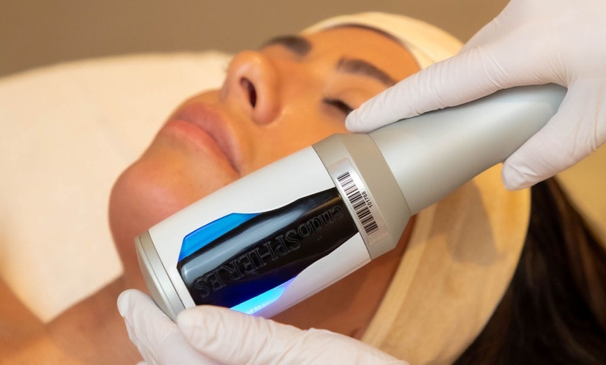 Image 2: Enhance Your Radiance with Endospheres Therapy Body or Face and Neck
