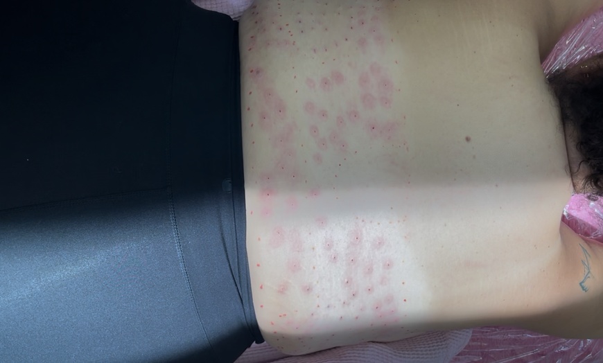 Image 5: Fat Dissolver at Pamper Me Pretty Day Spa